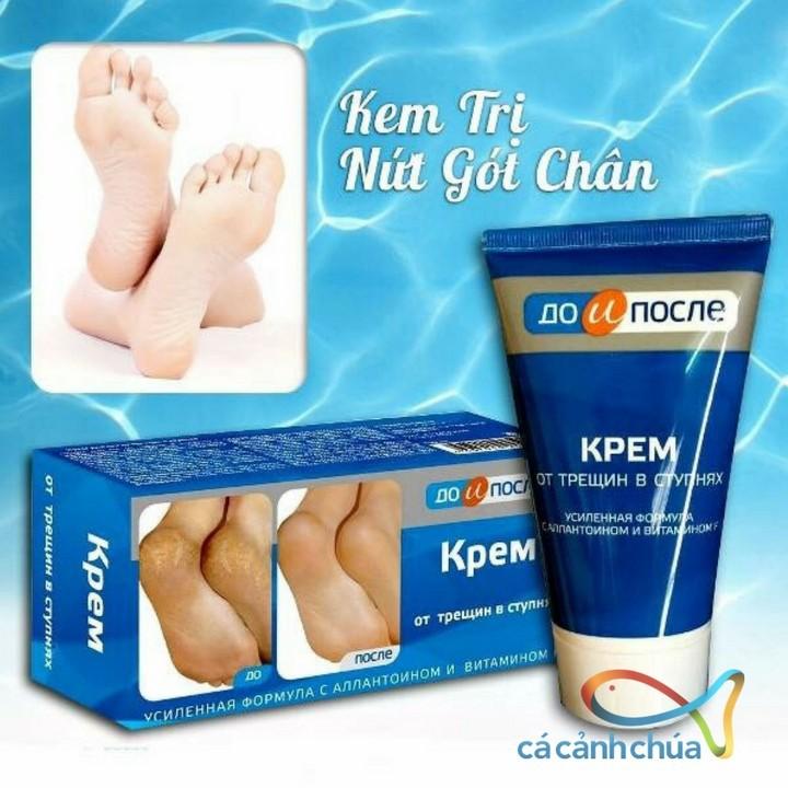 [Hoàn Tiền 8%]Kem Kpem Apteka Hỗ Trợ Cải Thiện Gót Chân Mềm Mại 50ml