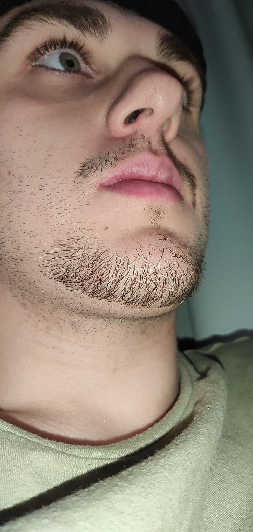 (MẪU MỚI) Minoxidil 5% Mọc Râu Tóc Dạng Bọt Không Gây Dị Ứng Da (Minoxidil 5% Foam)