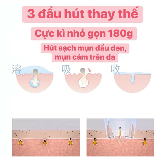 Máy Massage Rửa Mặt 5 In 1
