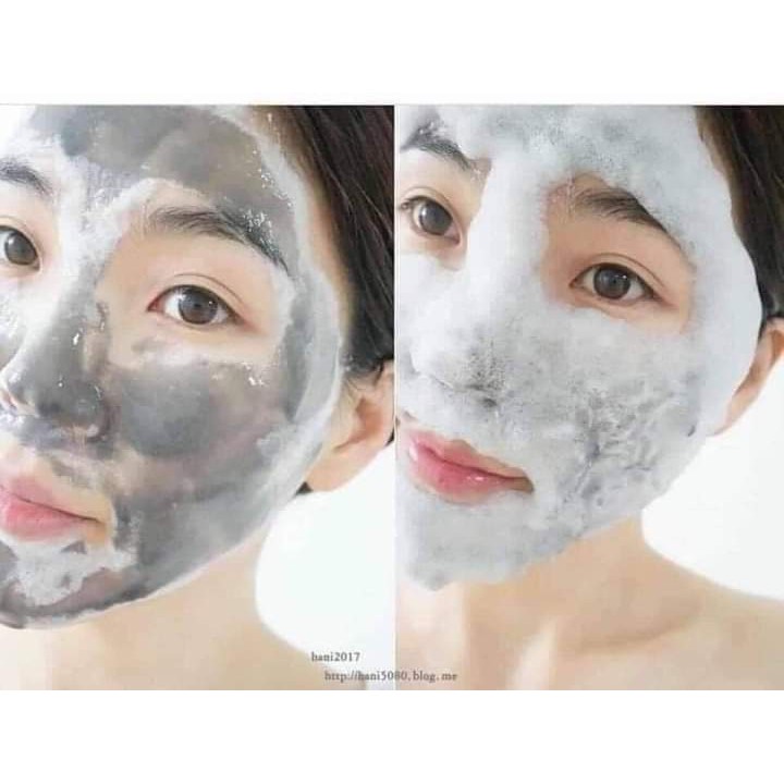 [HCM]Sẵn Mặt Nạ Thải Độc Sum:37 mask