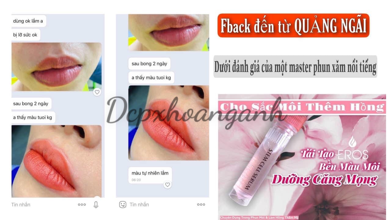 Dưỡng Tế Bào Gốc Stem Cell Serum - Dcpxhoanganh