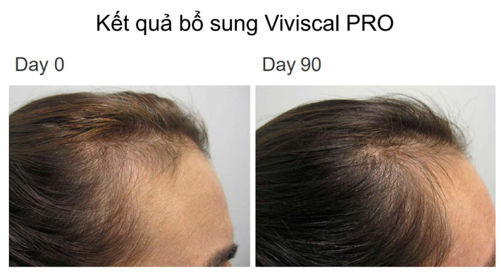 Viên uống hỗ trợ mọc tóc Viviscal PRO (60 viên)