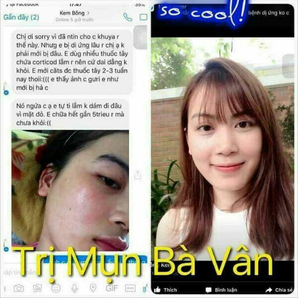 Đông Y Đa Năng Bà Vân Các Bệnh Ngoài Da