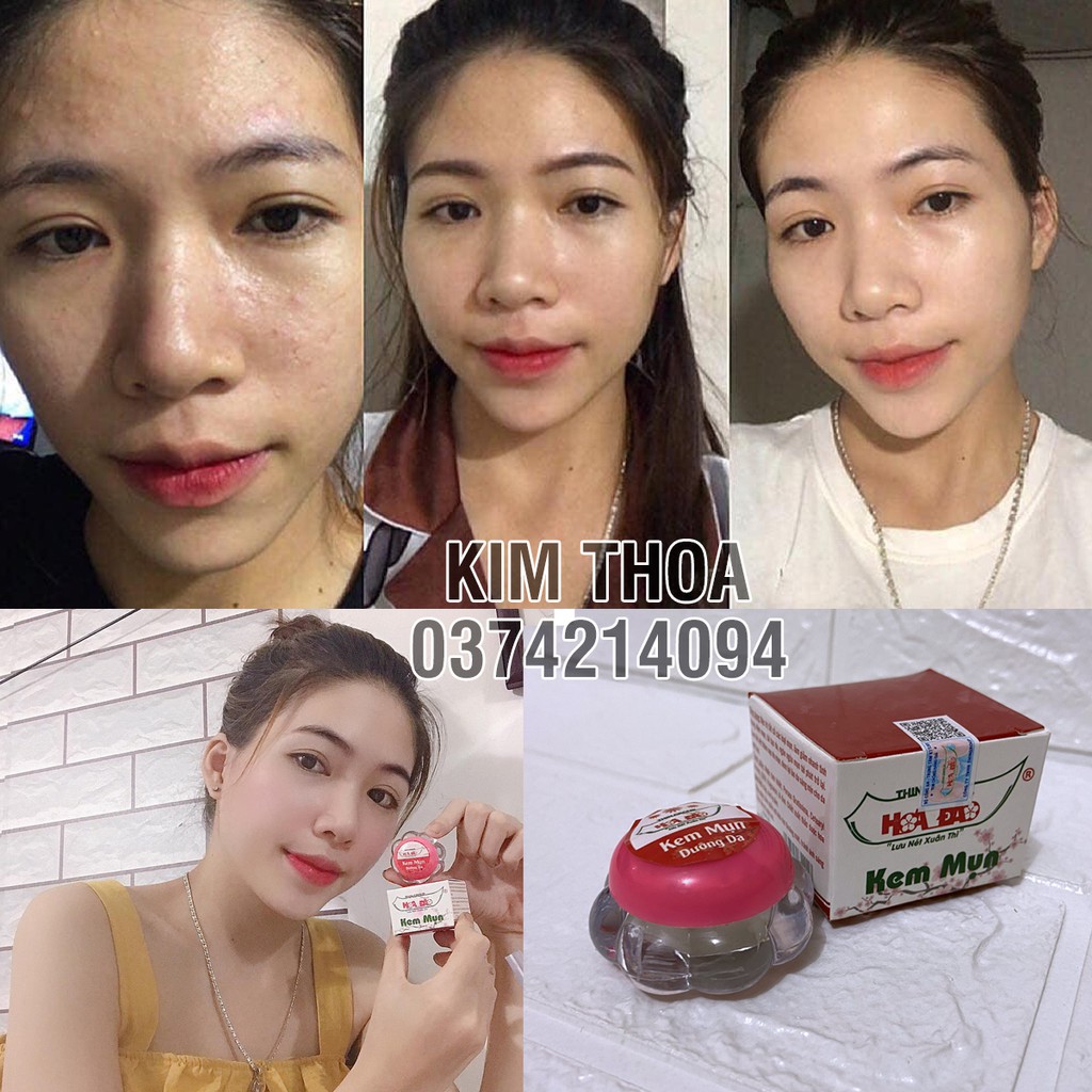 [CHÍNH HÃNG FREESHIP] Kem Mụn Dưỡng Da Hoa Đào
