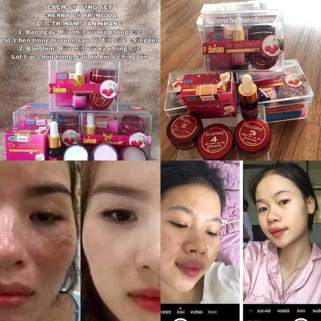 Bộ Nám và Sạm Da