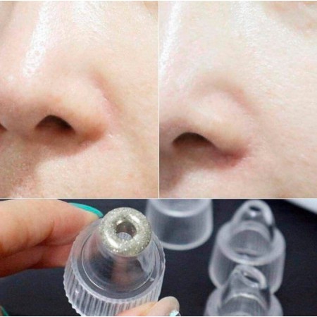 Máy Hút Mụn Đầu Đen Mini Cầm Tay