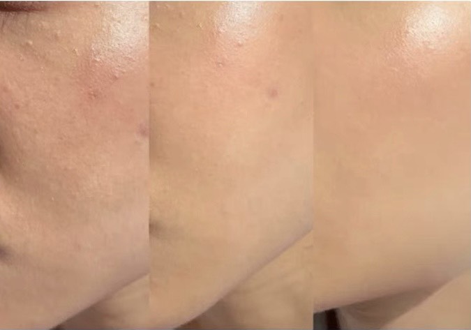 (100ml) Serum Phục Hồi Da Estee Lauder Advanced Night Repair