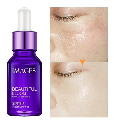 [ Chất lượng ⭐⭐⭐⭐⭐] Serum mụn và trắng da Images Perilla Essence 15ml