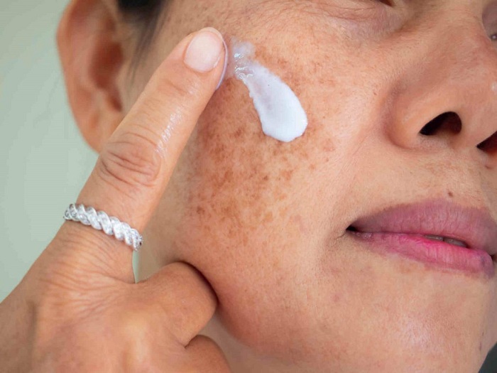 Kem giảm nám tàn nhang CCM CREAM nội địa
