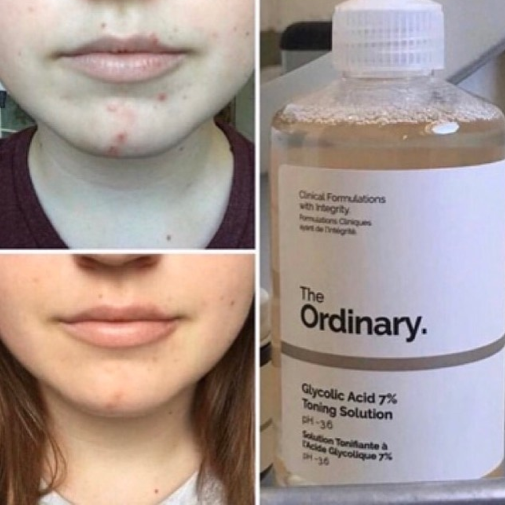 Toner The Ordinary  glycolic acid 7% 240ml Toning Solution