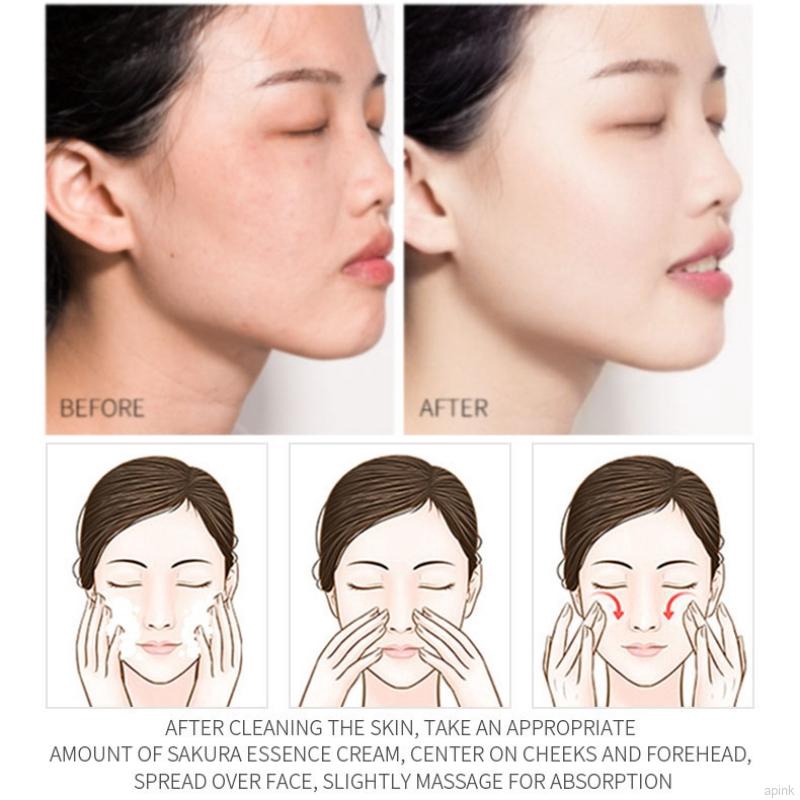 Kem dưỡng da mặt hoa anh đào Nhật Bản (nám, tẩy tàn nhang, giảm nếp nhăn chống lão hóa tinh chất anh đào)