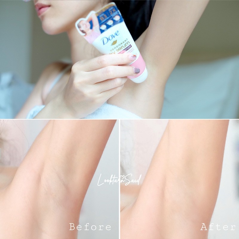 [Mã SKAMCLU9 giảm 10% đơn 100K] Kem Khử Mùi Dove Tinh Chất Serum Dưỡng Sáng 50ml