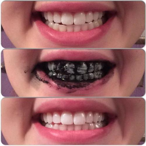 Bột Tẩy Trắng Răng Than Tre Hoạt Tính