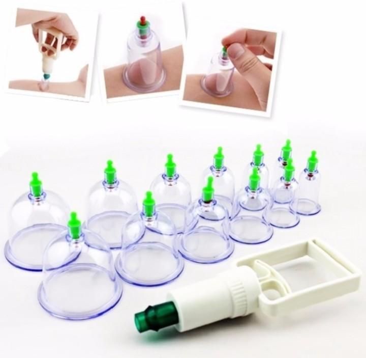 Bộ giác hơi 12 món không dùng lửa
