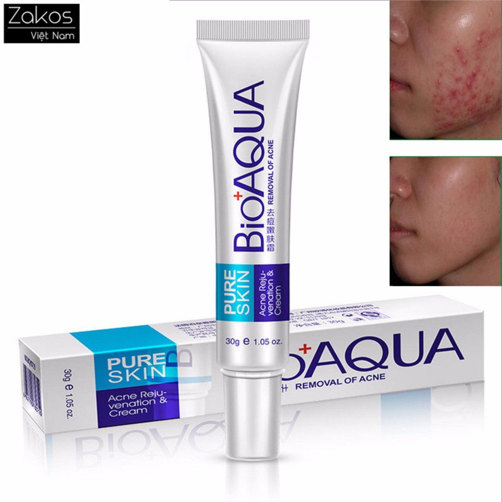 [HCM]Kem mụn Bioaqua Pure skin Nội địa Trung - BUMSTORE