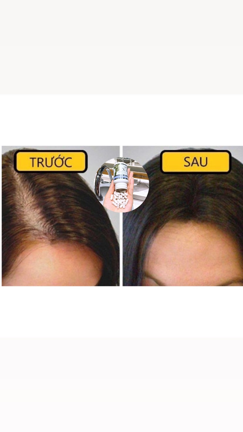 Viên Uống Mọc Tóc Best Biotin Supplement EX (90 Viên)