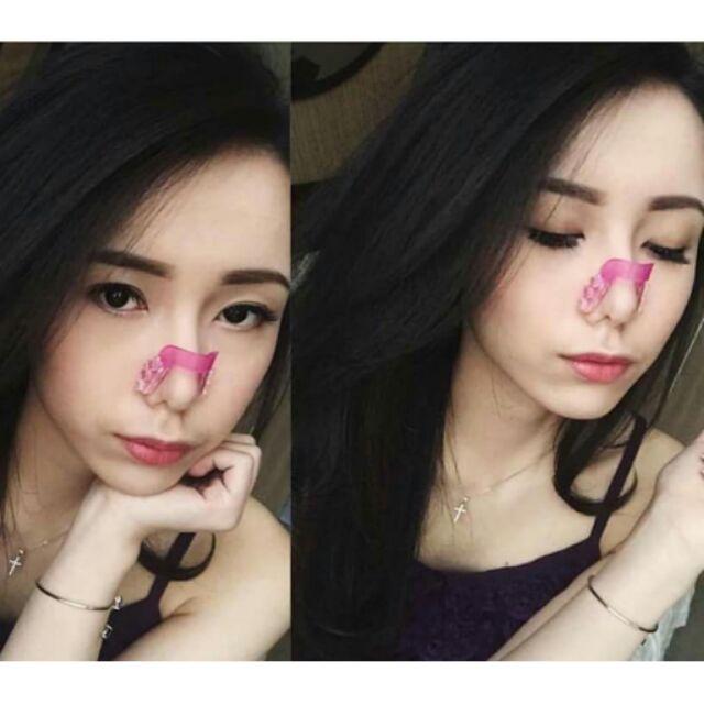 Kẹp Nâng Cao Sóng Mũi