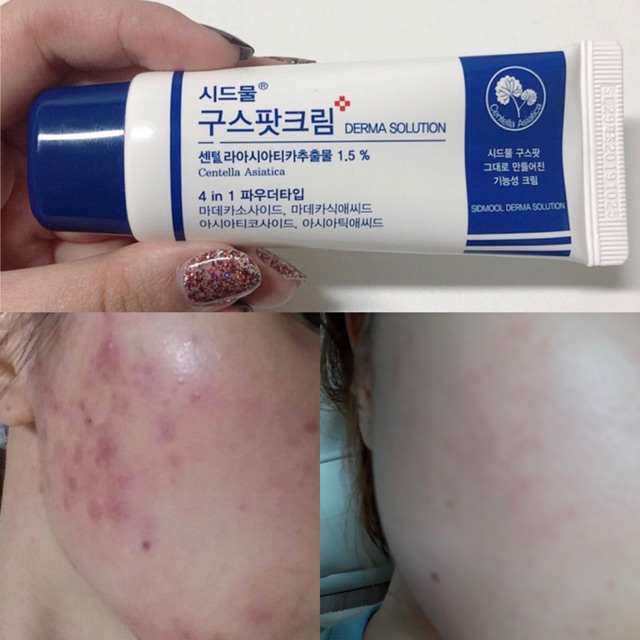[HCM]Kem dưỡng da mụn Sidmool centella good spot cream 30ml