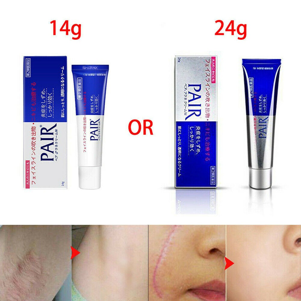 Kem ngừa mụn Pair Acne W Cream Nhật Bản