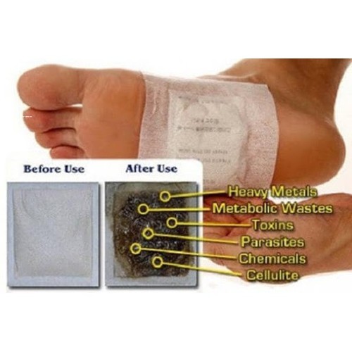 Thải Độc Chân Lanna Foot Patch Thái Lan (10 miếng)