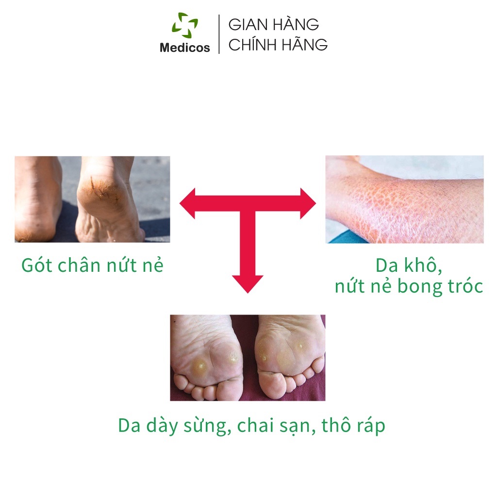 [HCM]Kem Bôi Nứt Gót Chân Medicosh Callucare 50ml