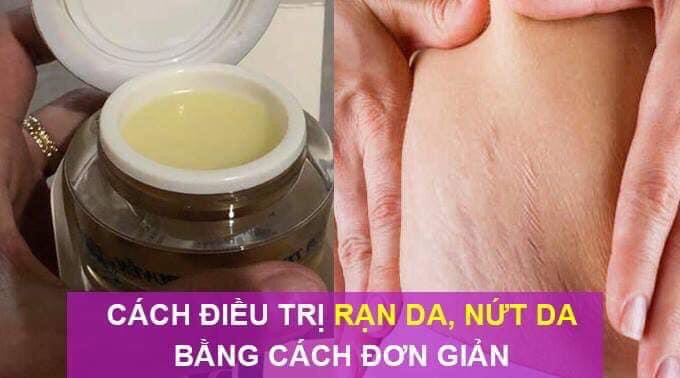 Kem chống lão hóa và làm đẹp da Bách Hoa Linh