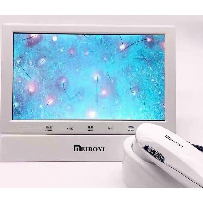 Máy soi da màn hình 10 inch nhỏ gọn cho spa