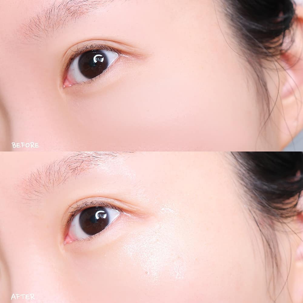 Combo Dưỡng Da Red Peel Clear Stick Và Silk Collagen Ampoule