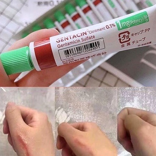 Kem mờ sẹo Gentacin Nhật Bản tuýp 10g