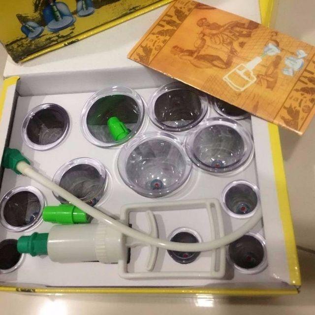 Bộ giác hơi KN 12 cốc không dùng lửa không cần dây