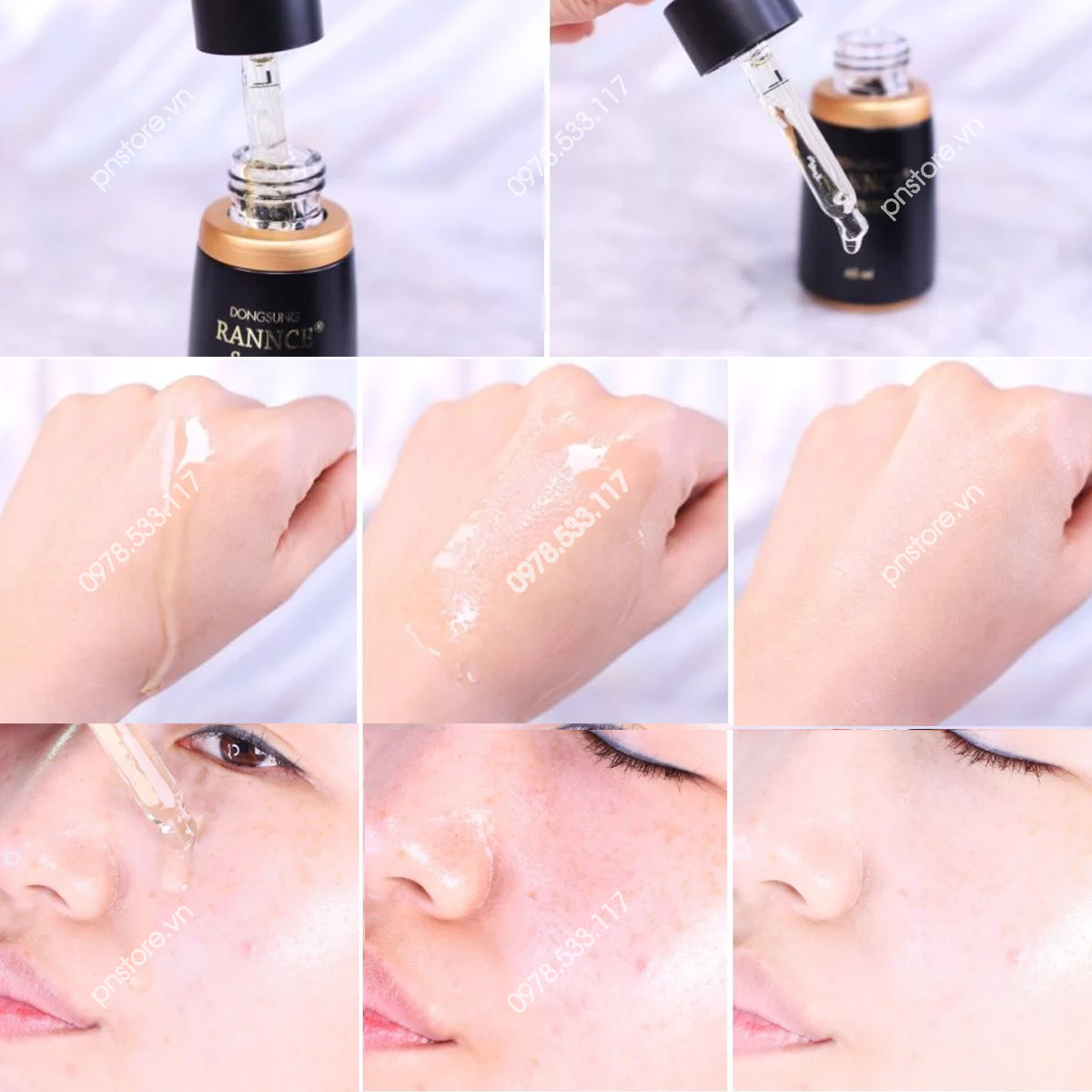 Serum Nám Dongsung Rannce Serum - 45ml