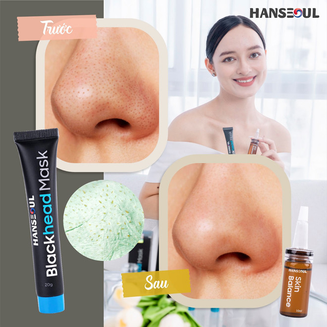 Gel lột mụn cám,mụn đầu đen Blackhead Mask, mặt nạ lột mụn không gây đau rát, kháng khuẩn, se khít lỗ chân lông tuýp 20g chính hãng Hanseoul