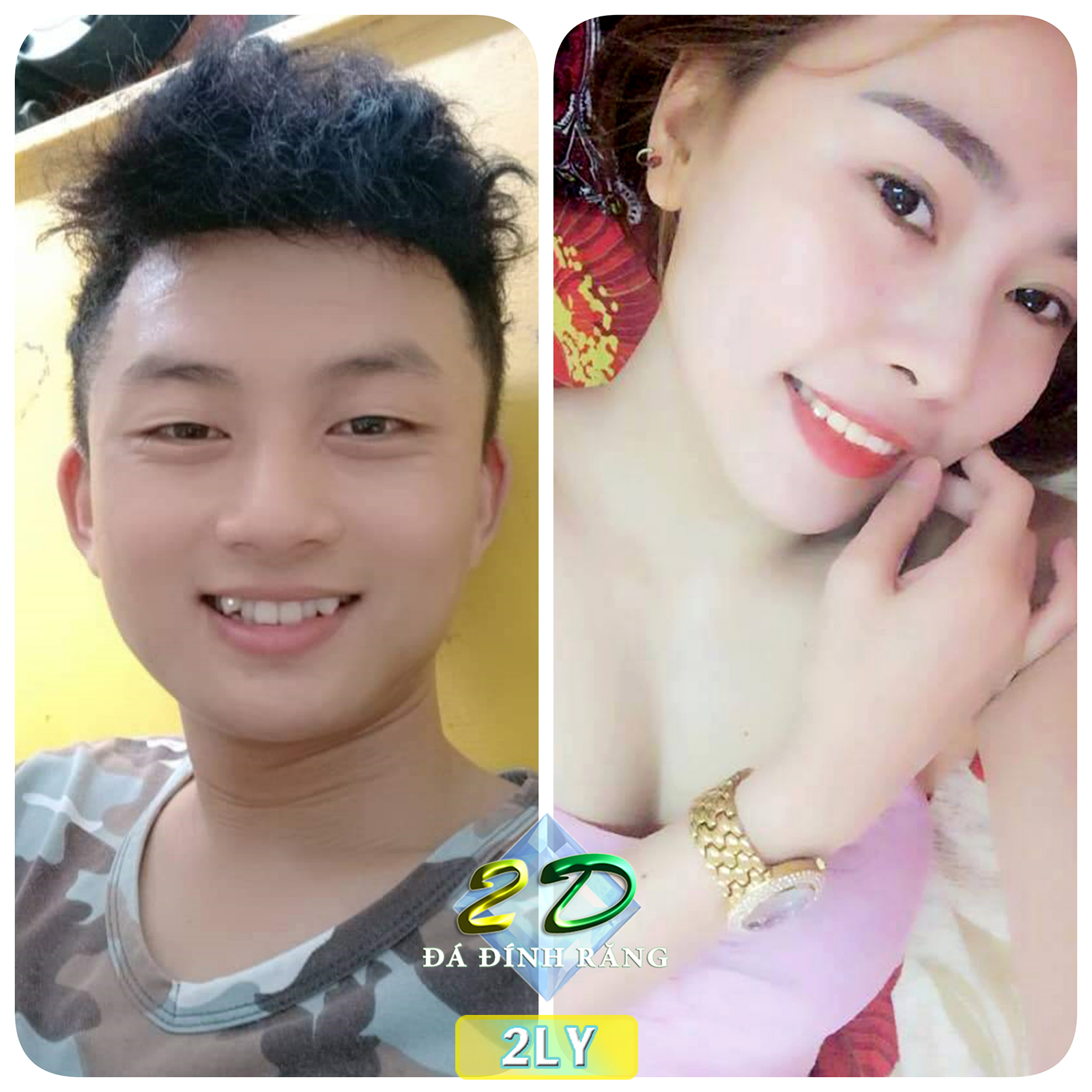 Mua 1 tặng 1 -Đá đính răng Thụy Sĩ 2LY (loại nhỏ xinh xinh)