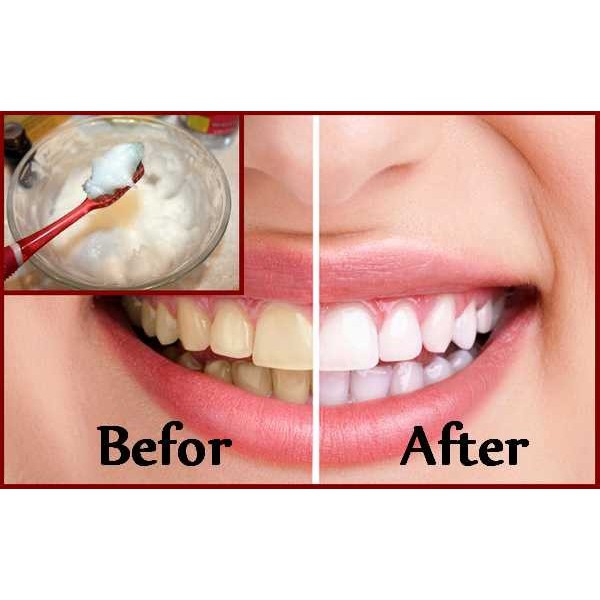 BỘT BAKING SODA ARM & HAMMER