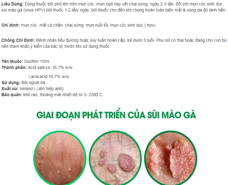 chai chân, mụn cóc, chai sừng, mụn cơm, virut hpv, smg