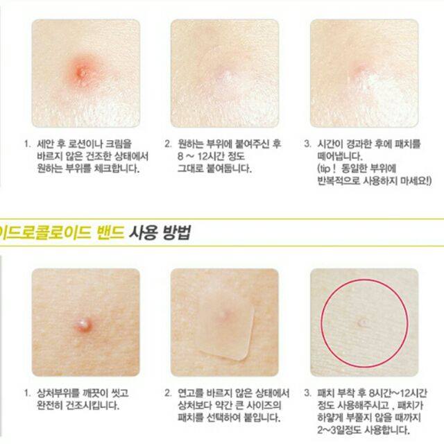[HCM]Miếng dán mụn NEXCARE - Hút và giảm mụn hiệu quả