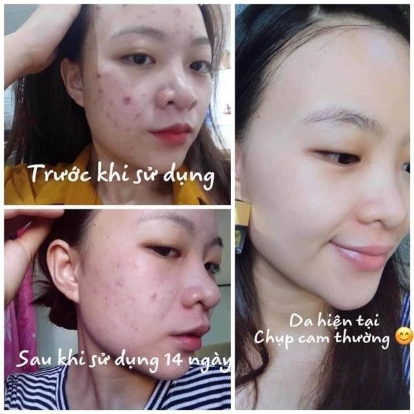 [HCM]Cao Mụn Sâm Đỏ (15g/hộp) Chính Hãng Meea Oranic