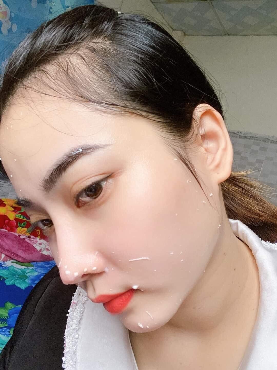TẨY DA CHẾT DỊU NHẸ PHƯƠNG ANH