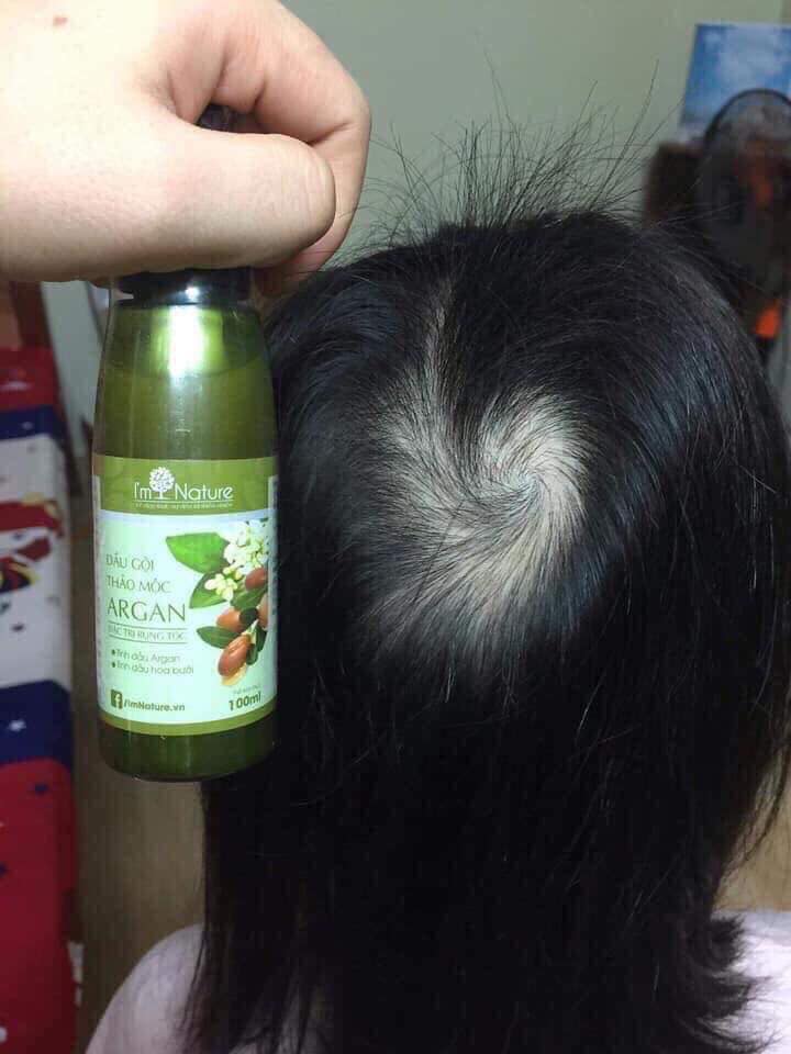 Tinh Chất Dưỡng Tóc Argan 60ml Giúp Mọc Tóc Đen Ngăn Rụng Tóc I'm Nature