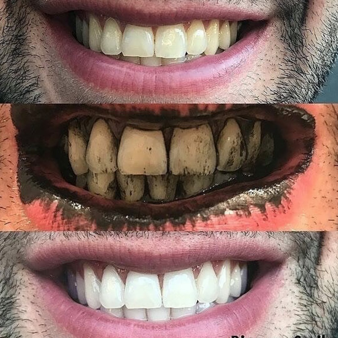 Viên đánh trắng răng Lush - Boom Toothy Tabs