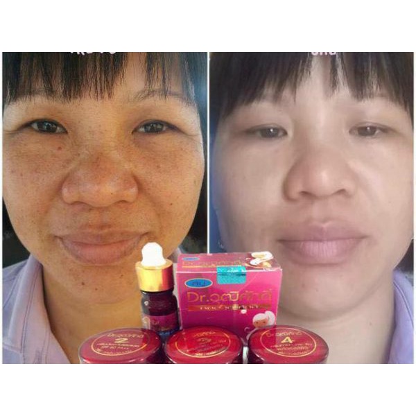 Set nám Yanhe đỏ thái lan (bộ 5 món)