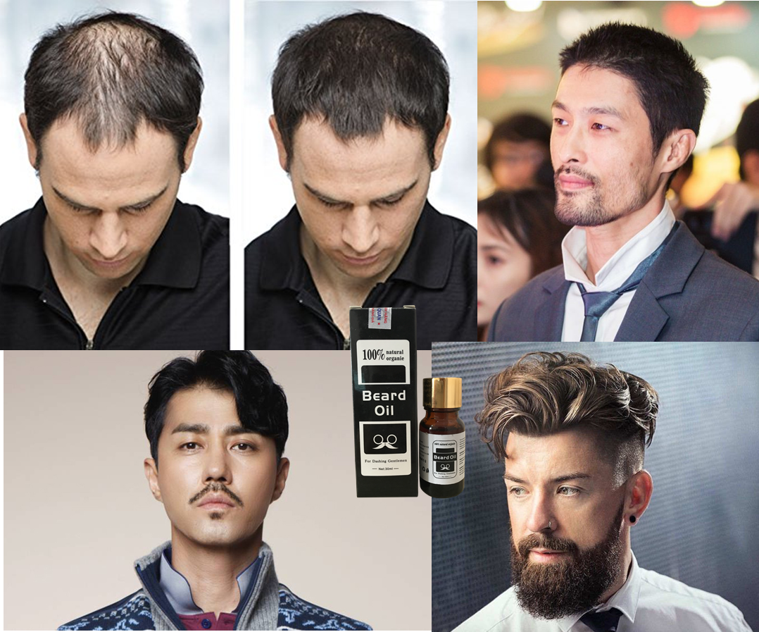Mọc Râu Mọc Tóc Mọc Lông Mày Beard Oil