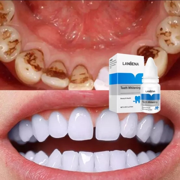 LANBENA TRẮNG RĂNG Teeth Clean Spot Cleaning LÀM SẠCH RĂNG Teeth Whitening TRẮNG RĂNG Teeth White Intensive Whitening Treatment