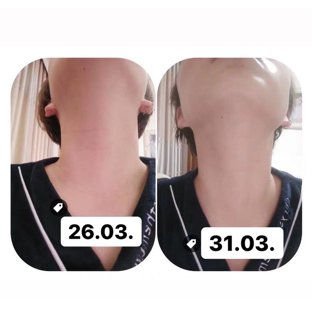 kem dưỡng cổ Medi Peel Naite Thread Neck Cream