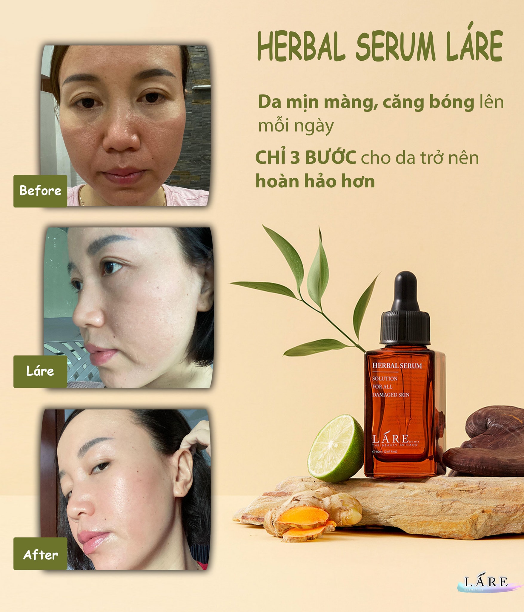 Combo 2 Serum Thảo Mộc Thanh Dược Lare 80ml