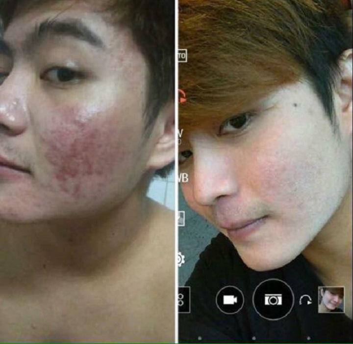 [HCM]Cổ Mộc Lan Siêu Tốc 50ml