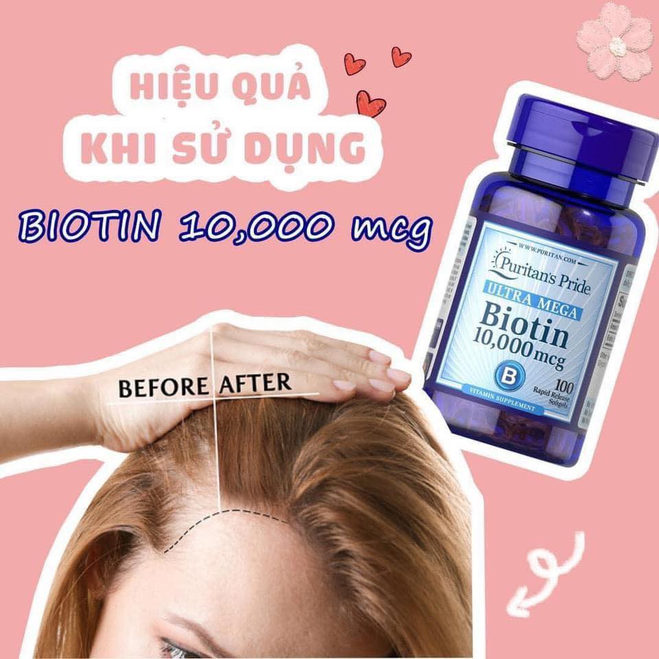 Biotin Puritan's Pride 10,000 mcg 100 viên
