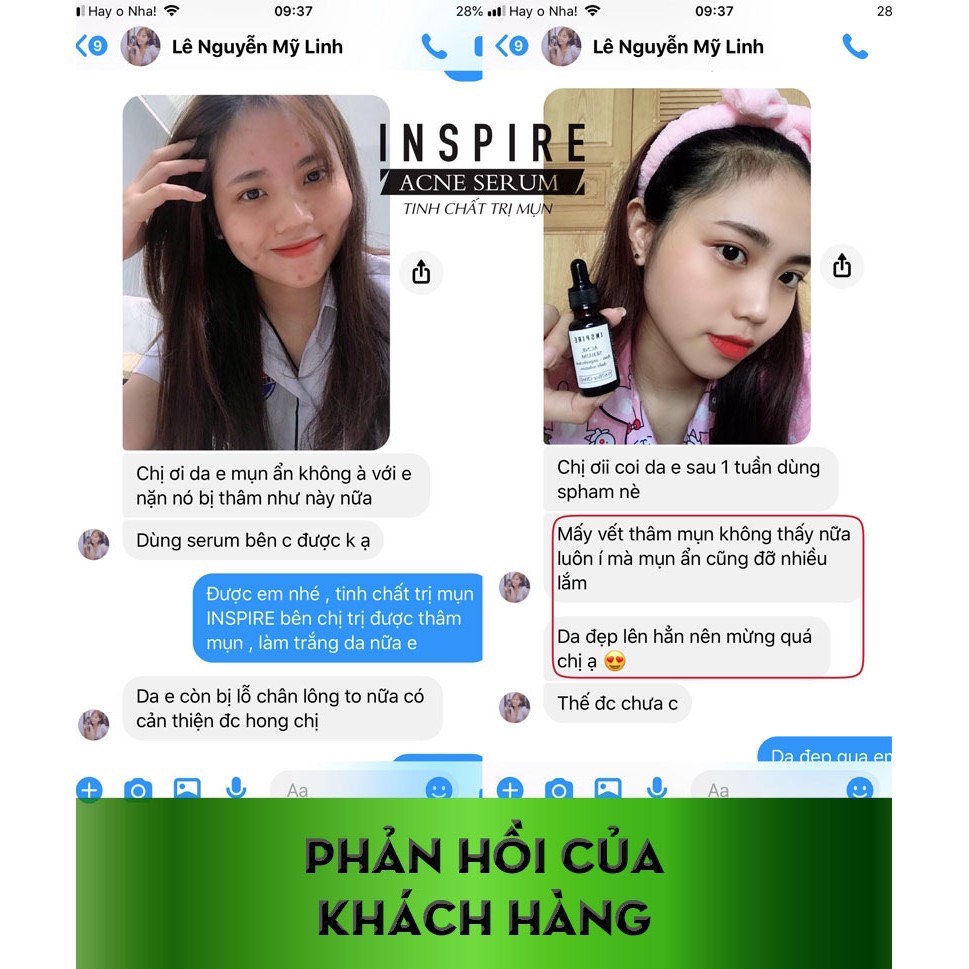 Tinh chất ngừa mụn acne inspire