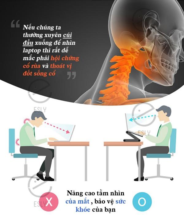 PKTL - GIÁ ĐỠ LAPTOP ESLY 360°