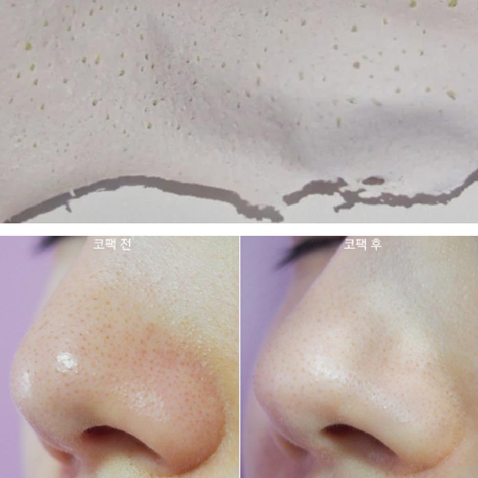 Gel Lột Mụn Tro Núi Lửa Jeju Volcanic Lava